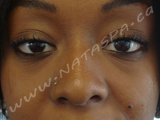 Permanent Makeup, Before and After, Toronto, Concord ...