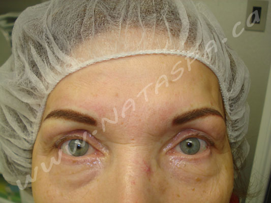 Permanent Makeup, Before and After, Toronto, Concord ...