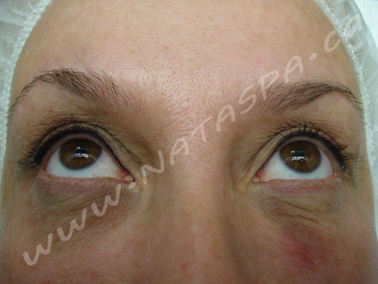Permanent Makeup, Before and After, Toronto, Concord ...